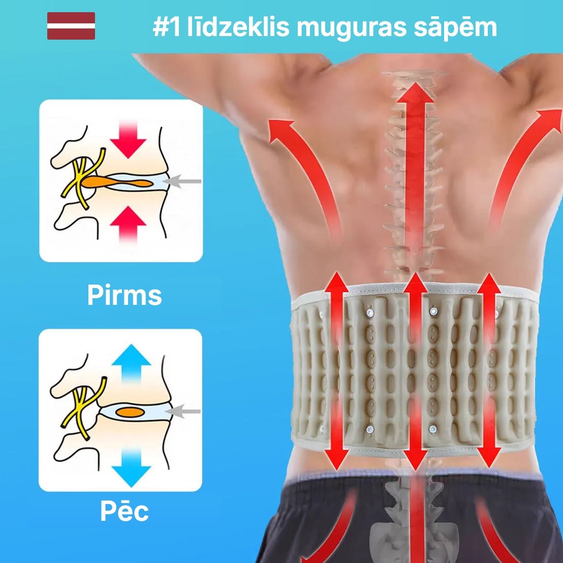 Neurogena muguras josta ar dekompresiju